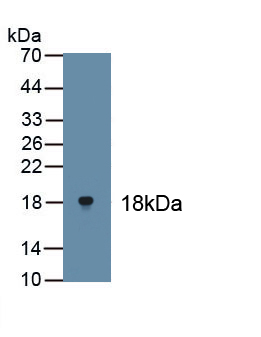 Polyclonal Antibody to Tumor Protein P63 (TP63)