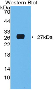 Polyclonal Antibody to Complement Component 1, Q Subcomponent A (C1qA)