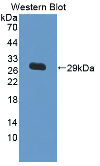 Polyclonal Antibody to Interleukin 17 Receptor C (IL17RC)