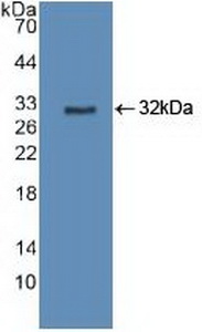 Polyclonal Antibody to Cytochrome P450 27B1 (CYP27B1)