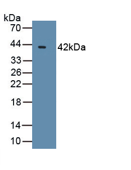 Polyclonal Antibody to B-Cell CLL/Lymphoma 7A (Bcl7A)
