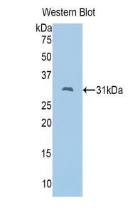 Polyclonal Antibody to Fascin 2 (FSCN2)