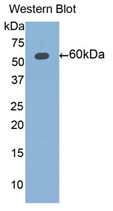 Polyclonal Antibody to Aldehyde Dehydrogenase 7 Family, Member A1 (ALDH7A1)