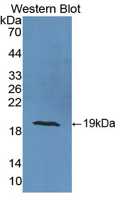 Polyclonal Antibody to Cellular Retinoic Acid Binding Protein 2 (CRABP2)