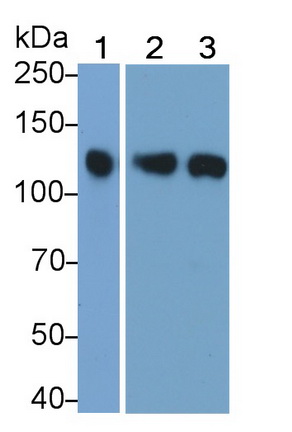 Polyclonal Antibody to Janus Kinase 3 (JAK3)