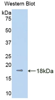 Polyclonal Antibody to Kinesin Family, Member 5A (KIF5A)