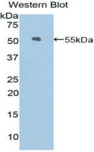 Polyclonal Antibody to Kinesin Family, Member 5A (KIF5A)