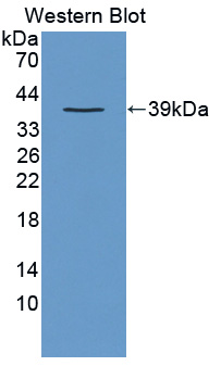 Polyclonal Antibody to Crk Like Protein (CRKL)