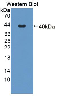 Polyclonal Antibody to Ankyrin Repeat Domain Protein 1 (ANKRD1)