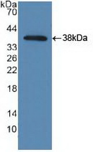 Polyclonal Antibody to TANK Binding Kinase 1 (TBK1)