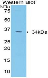 Polyclonal Antibody to Serine Peptidase Inhibitor Kazal Type 5 (SPINK5)