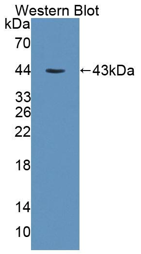 Polyclonal Antibody to Protein Kinase, X-Linked (PRKX)