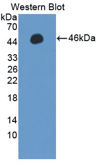 Polyclonal Antibody to Protein Phosphatase, Mg2+/Mn2+ Dependent 1A (PPM1A)