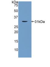 Polyclonal Antibody to Paraneoplastic Antigen MA2 (PNMA2)