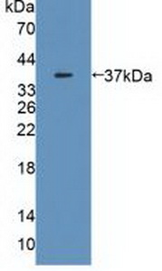 Polyclonal Antibody to Malate Dehydrogenase 2 (MDH2)