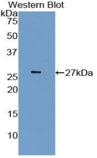 Polyclonal Antibody to Latexin (LXN)