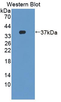 Polyclonal Antibody to F-Box And Leucine Rich Repeat Protein 3 (FBXL3)