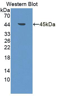 Polyclonal Antibody to Bcl2/Adenovirus E1B 19kDa Interacting Protein 3 (BNIP3)
