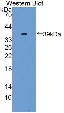 Polyclonal Antibody to GLI Family Zinc Finger Protein 3 (GLI3)