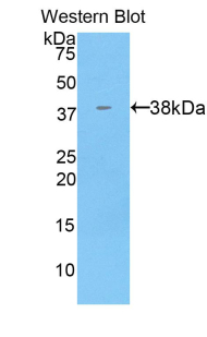 Polyclonal Antibody to Keratin 71 (KRT71)