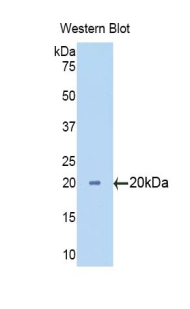 Polyclonal Antibody to Cytochrome P450 3A7 (CYP3A7)