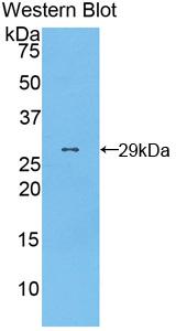 Polyclonal Antibody to Torsin A Interacting Protein 2 (TOR1AIP2)