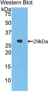 Polyclonal Antibody to Torsin A Interacting Protein 2 (TOR1AIP2)