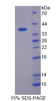 Recombinant Interleukin 12B (IL12B)