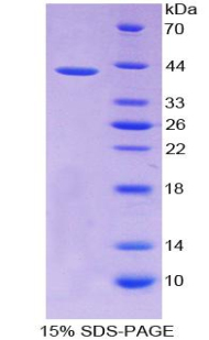Recombinant Monocyte Chemotactic Protein 1 (MCP1)