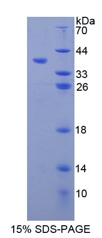 Recombinant Matrix Metalloproteinase 10 (MMP10)