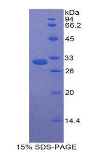 Recombinant Carboxypeptidase B2 (CPB2)