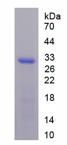 Recombinant Coagulation Factor XIII A1 Polypeptide (F13A1)