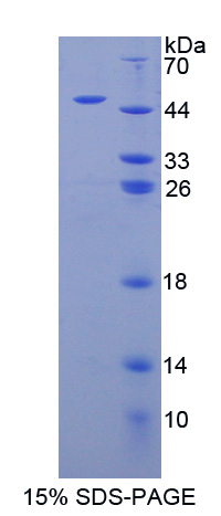 Recombinant Pituitary Adenylate Cyclase Activating Peptide (PACAP)