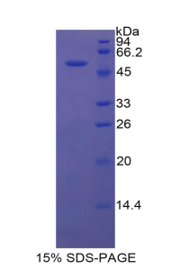 Recombinant Breast Cancer Susceptibility Protein 1 (BRCA1)