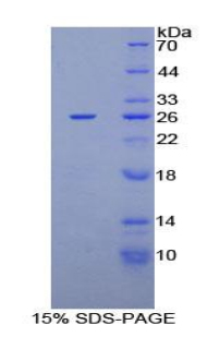 Recombinant Protein Kinase N2 (PKN2)