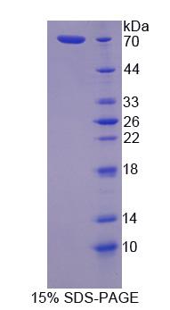 Recombinant Tight Junction Protein 1 (TJP1)