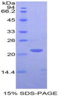 Recombinant T-Cell Surface Glycoprotein CD3 Epsilon (CD3e)