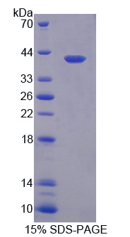 Recombinant Myosin Binding Protein C, Slow Type (MYBPC1)