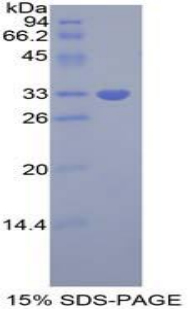 Recombinant Growth Factor Receptor Bound Protein 7 (Grb7)