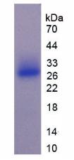 Recombinant Sclerostin Domain Containing Protein 1 (SOSTDC1)