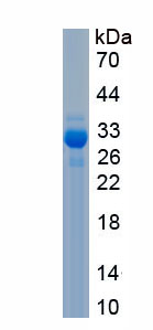Recombinant Protein Phosphatase, Mg2+/Mn2+ Dependent 1D (PPM1D)