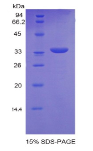 Recombinant Paraneoplastic Antigen MA2 (PNMA2)
