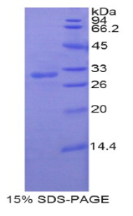Recombinant Paraneoplastic Antigen MA2 (PNMA2)