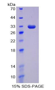 Recombinant DNA Methyltransferase 1 (DNMT1)