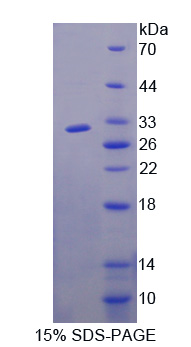 Recombinant F-Box And WD Repeat Domain Containing Protein 7 (FBXW7)