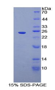 Recombinant Sprouty Homolog 3 (SPRY3)