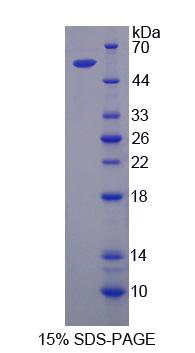 Recombinant Peptidase D (PEPD)