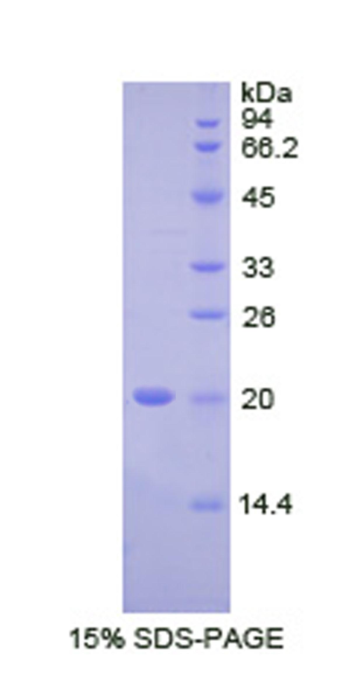 Recombinant Fc Fragment Of IgG Binding Protein (FcgBP)