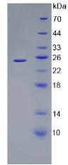 Recombinant Angiopoietin Like Protein 8 (ANGPTL8)