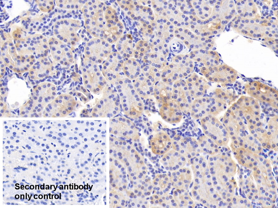 Anti-Vinculin (VCL) Polyclonal Antibody